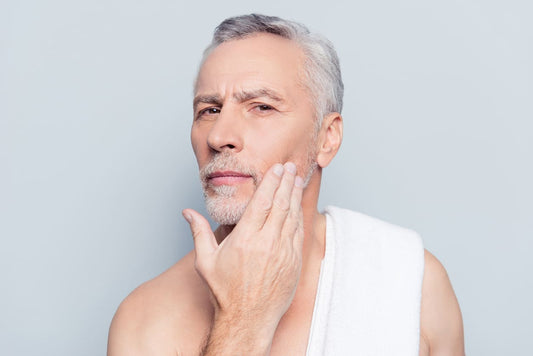 beard dandruff
